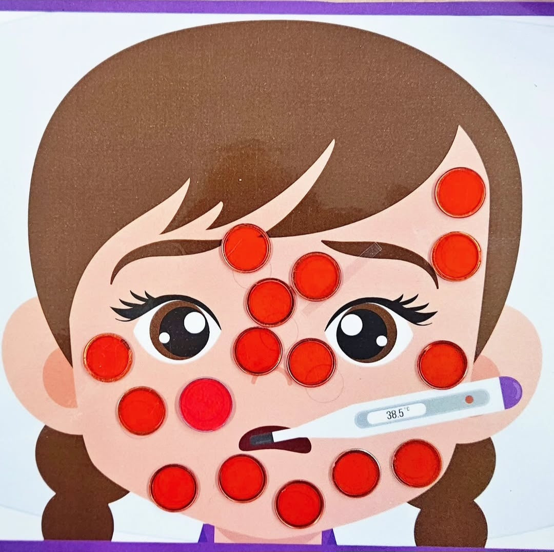 Chickenpox Game